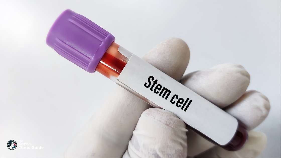 Stammzellangereicherte Eigenfetttransplantation in Korea | Die besten Kliniken, Kosten, Verfahrensvarianten und mehr