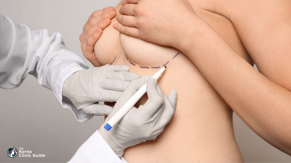 Brustvergrößerung mit Eigenfett in Korea | Die besten Kliniken, Kosten, Verfahren und mehr