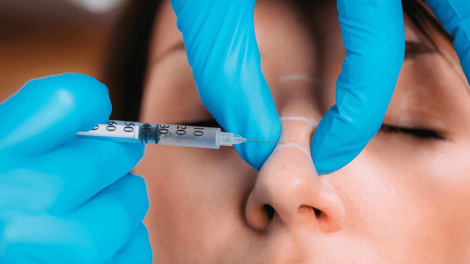 Nasenfiller in Korea | Die besten Kliniken, Behandlungsoptionen, Kosten und mehr!