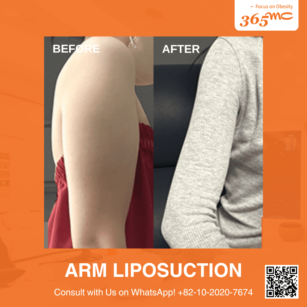 Before and After undefined