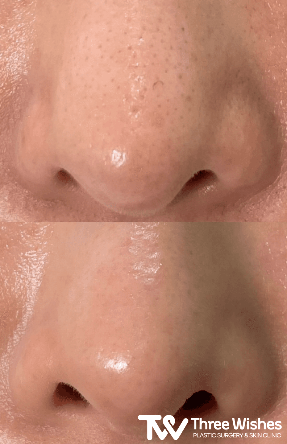 Before and After undefined