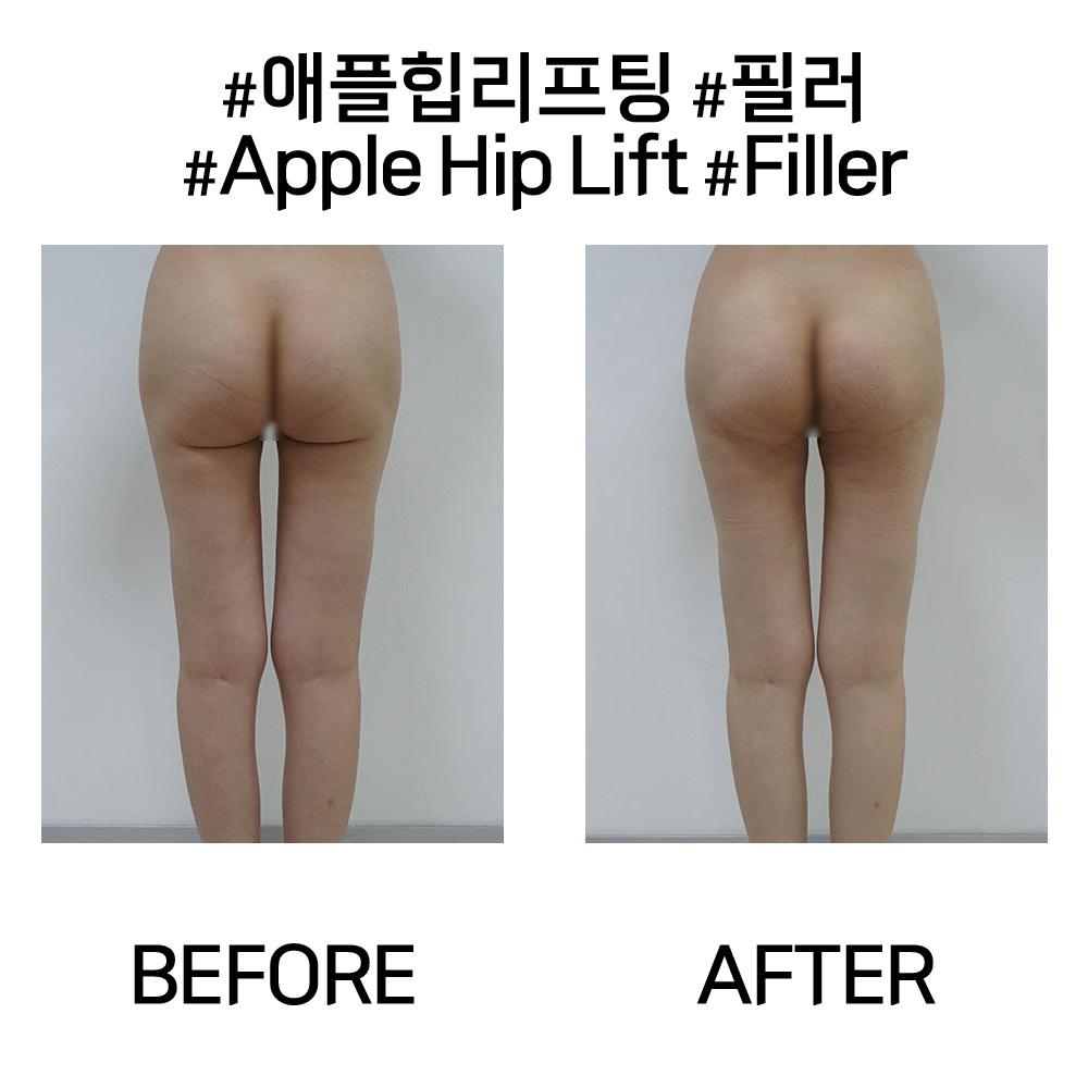 Before and After undefined