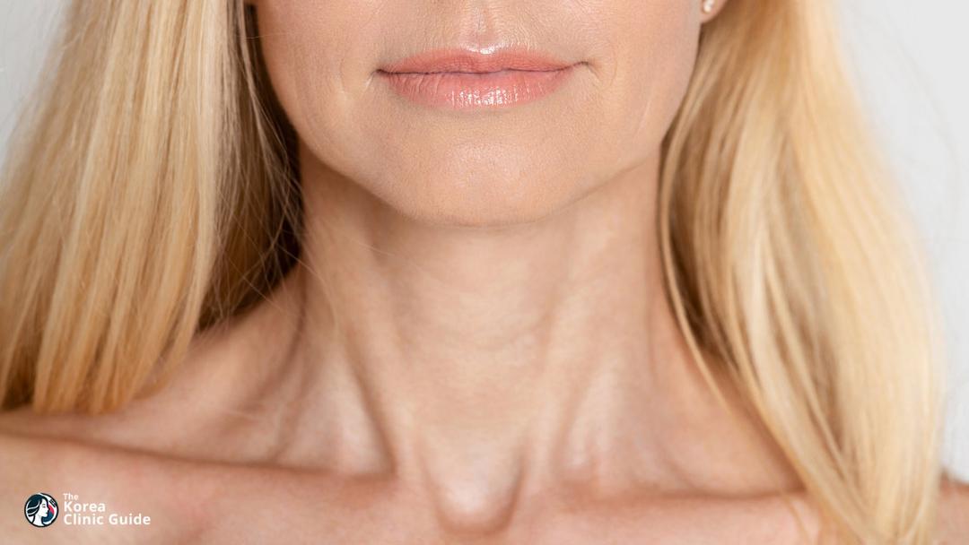 neck lift