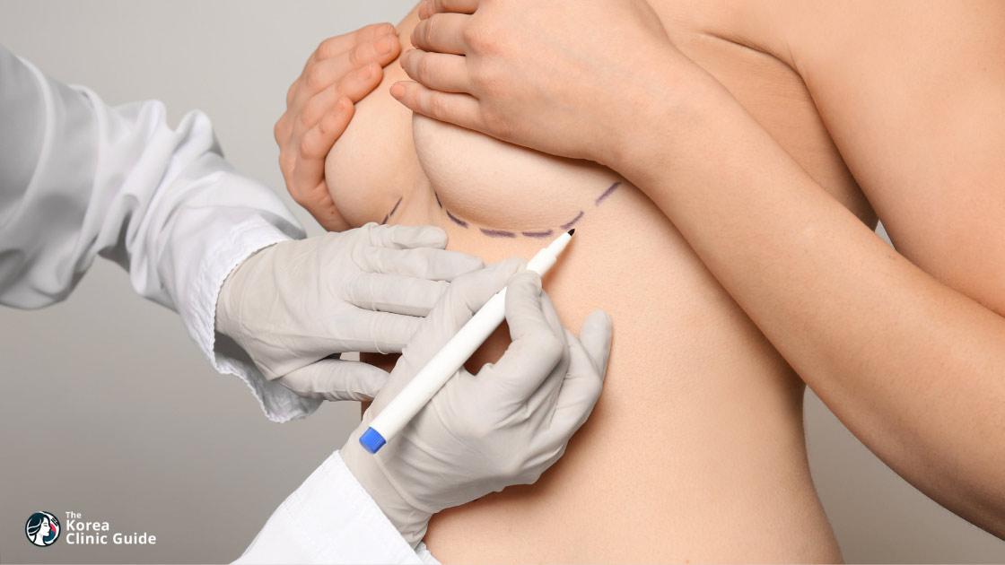 Brustvergrößerung mit Eigenfett in Korea | Die besten Kliniken, Kosten, Verfahren und mehr