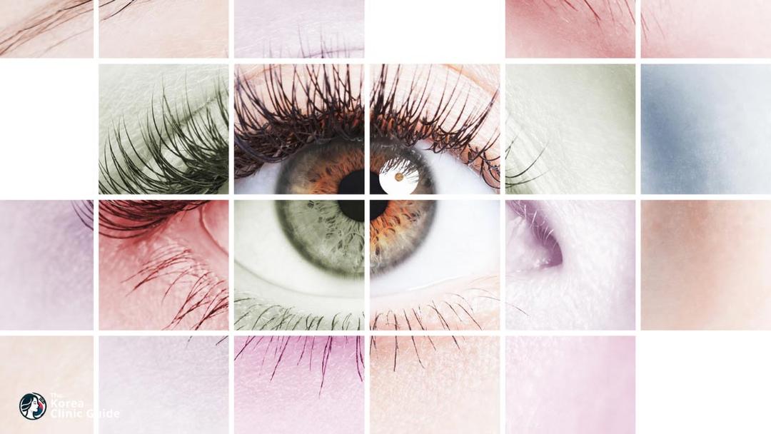 cataract surgery