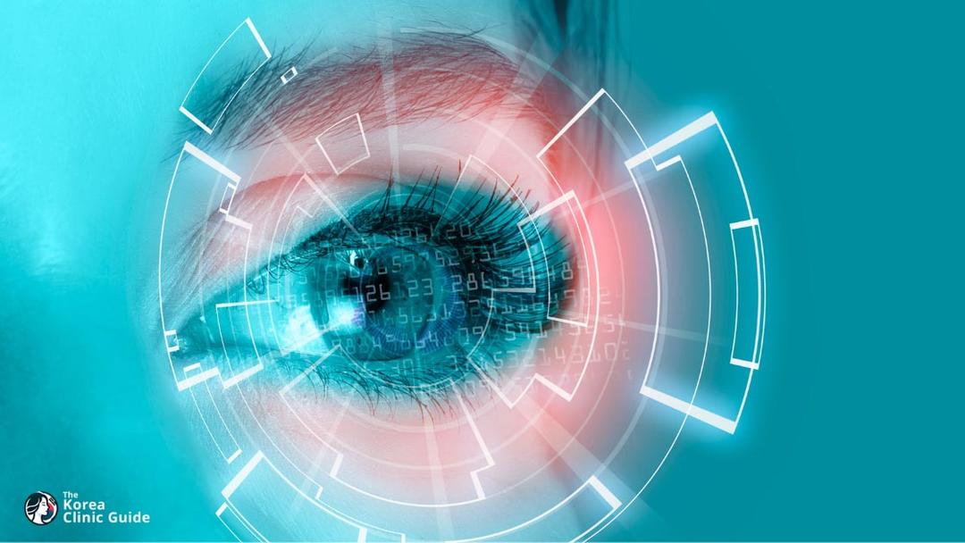 smile eye surgery