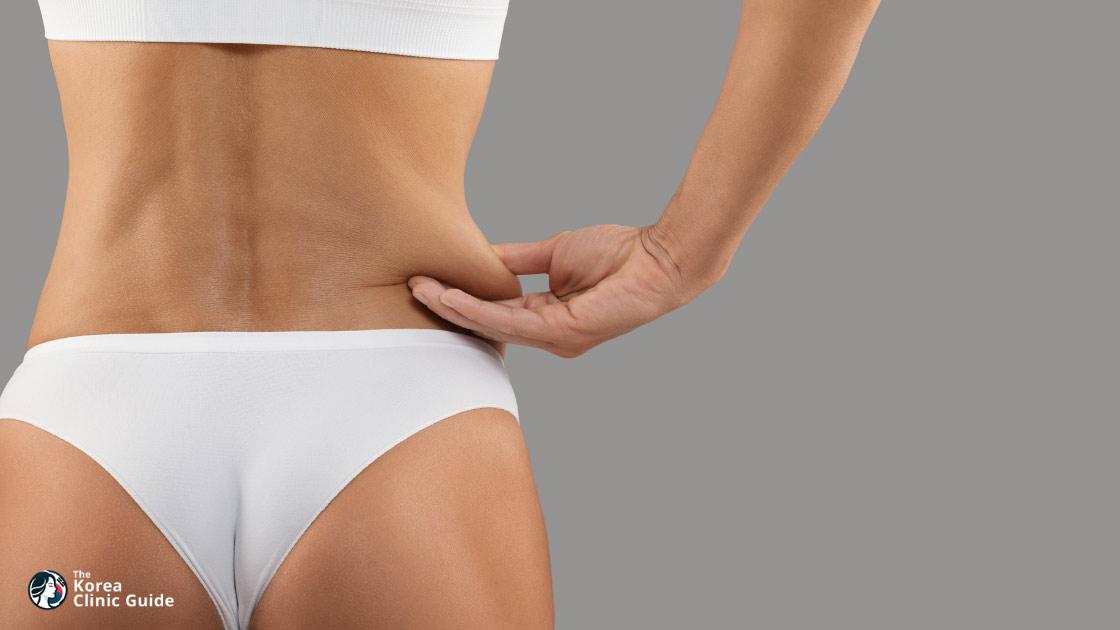 Taillen-Liposuktion in Korea | Die besten Kliniken, Kosten, Verfahrensmethoden und mehr