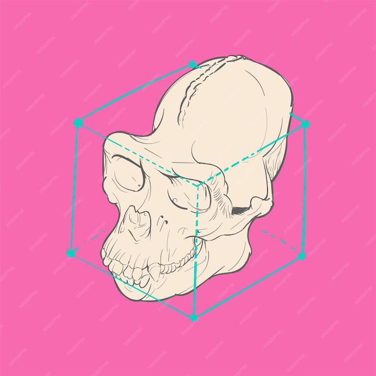 cheekbone reduction