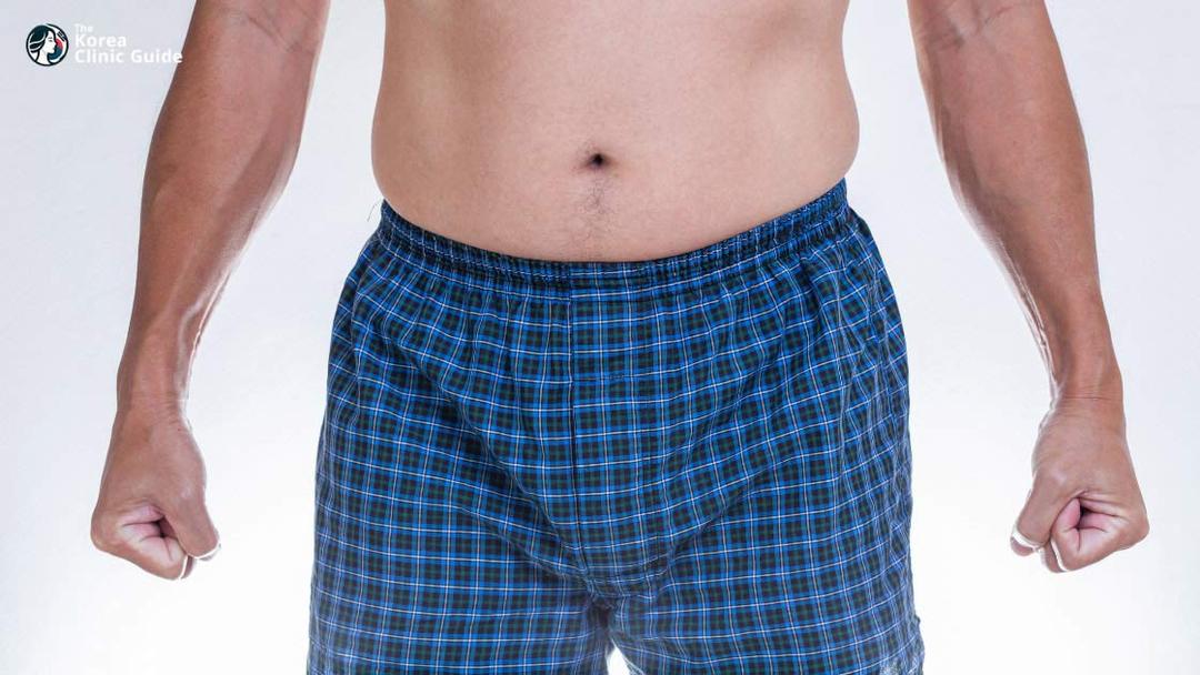 pubic fat pad removal