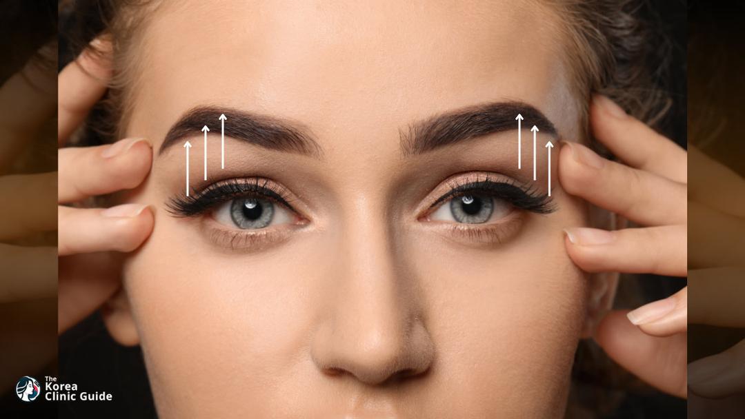 eyebrow lift