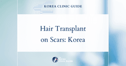 Hair transplant on Scar in Korea | Best Clinics, Costs, Procedure Types & More