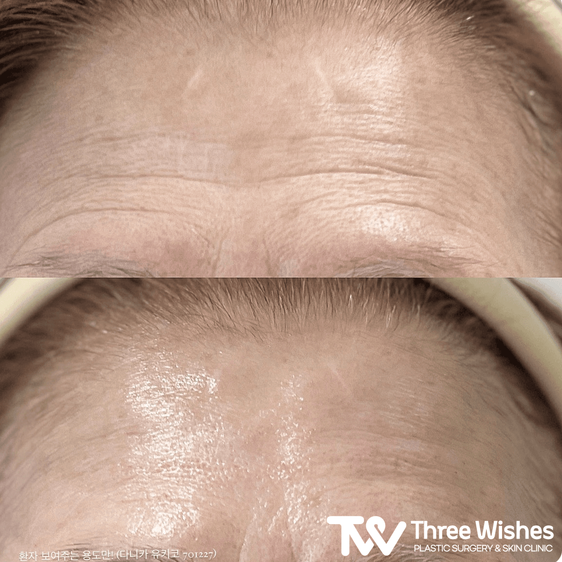 Three Wishes Clinic - Myeongdong before and after image