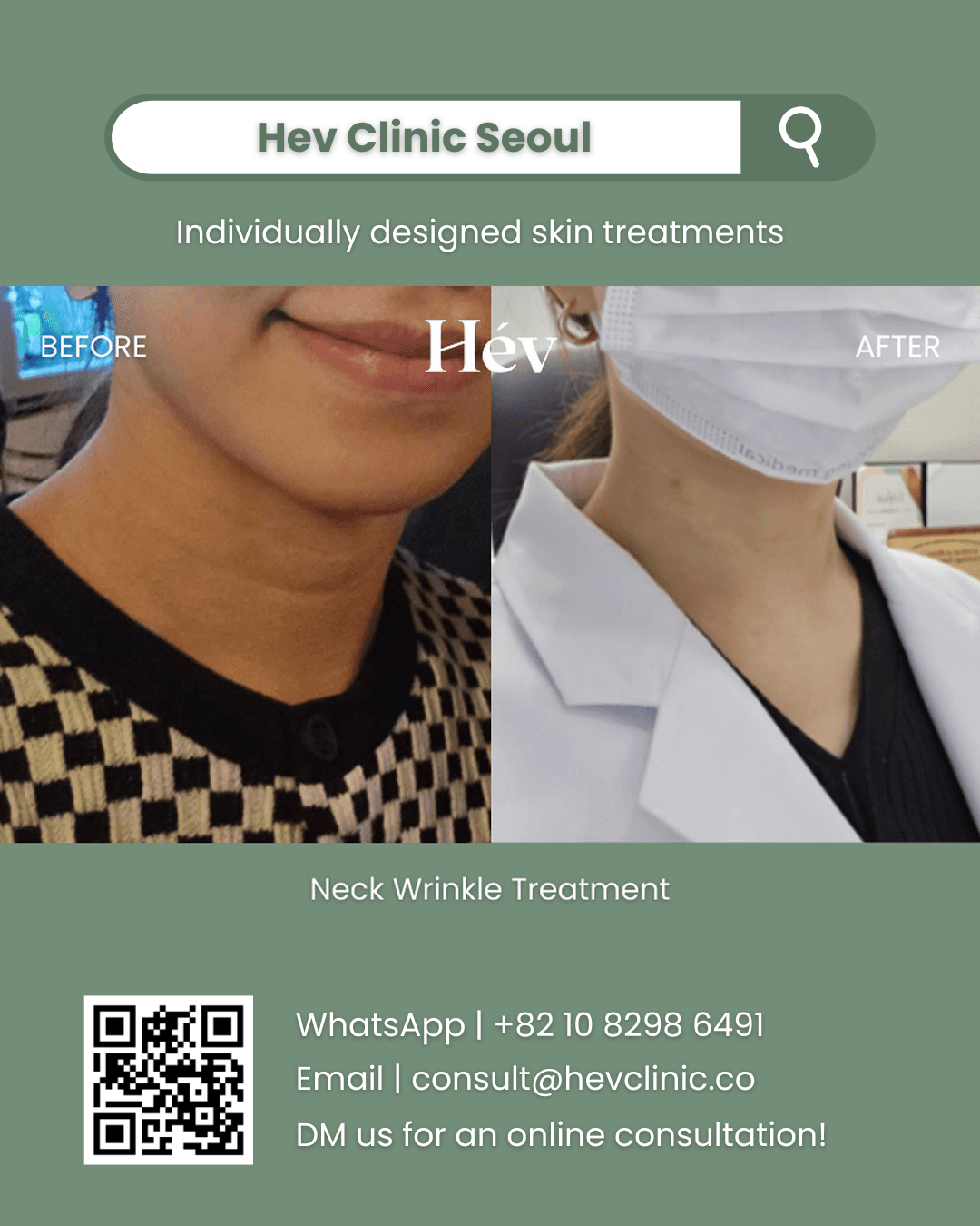 Neck Wrinkle Treatment