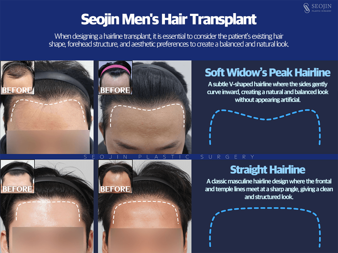 Hairline Correction