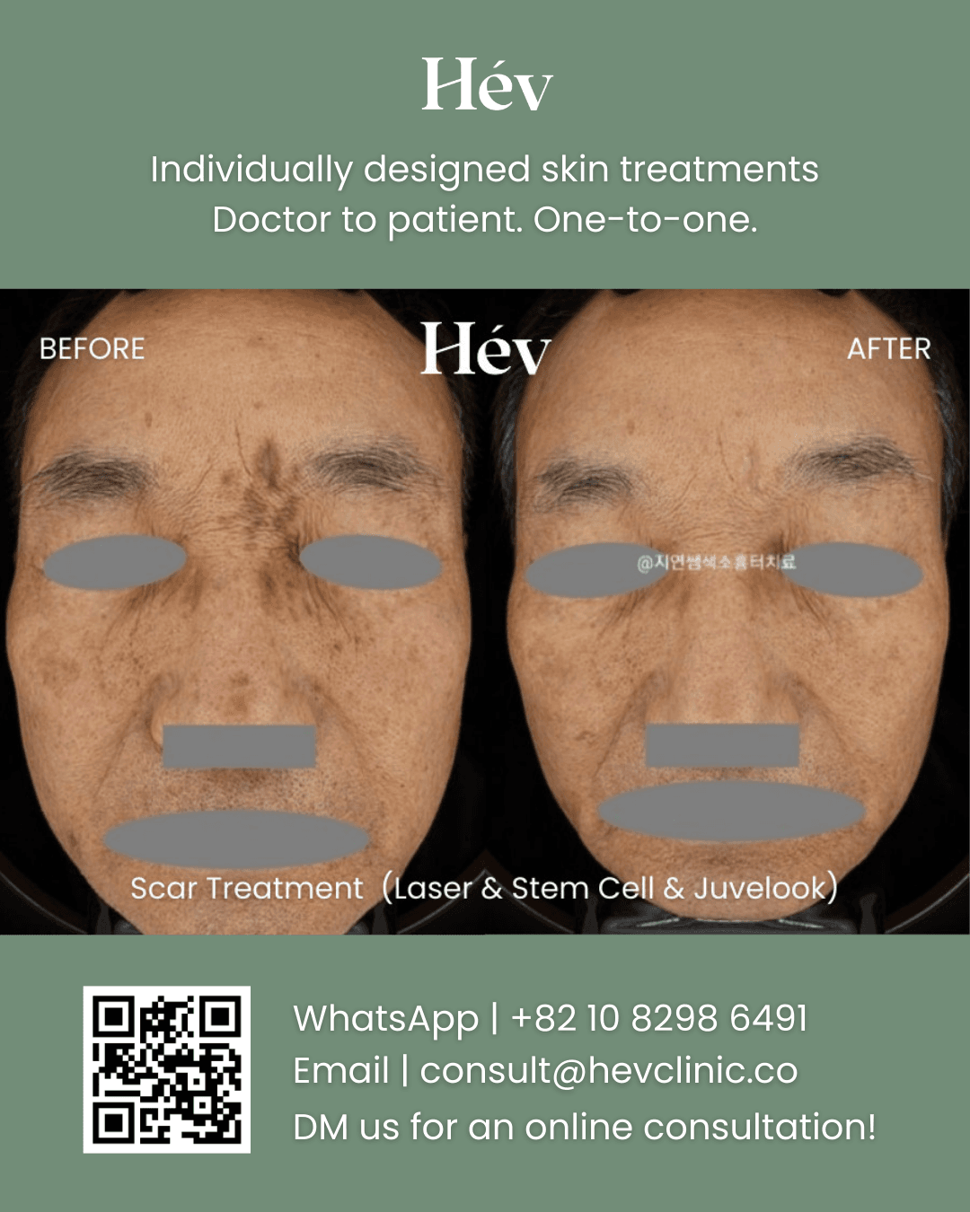Scar Removal Laser, Stem Cell Facial