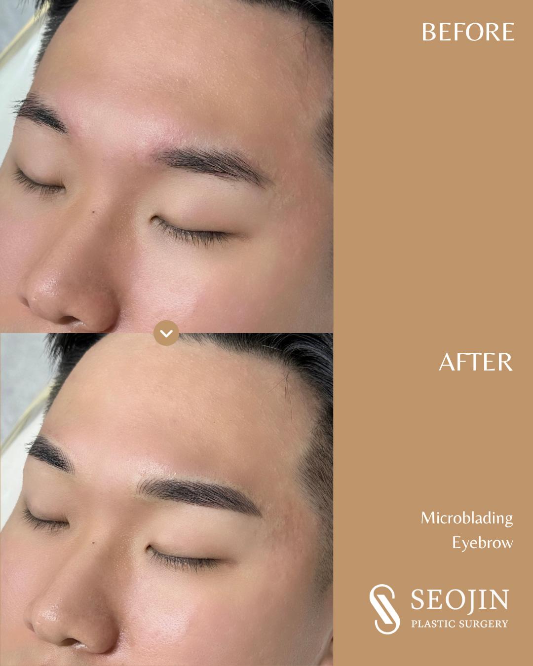 Microblading, Eyebrow Microblading