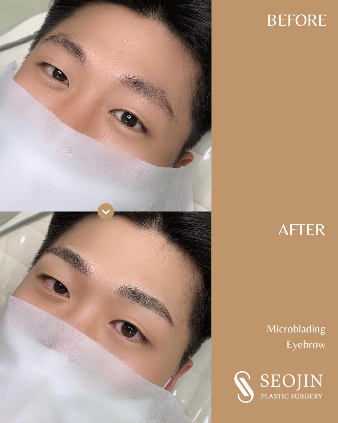 Microblading, Eyebrow Microblading