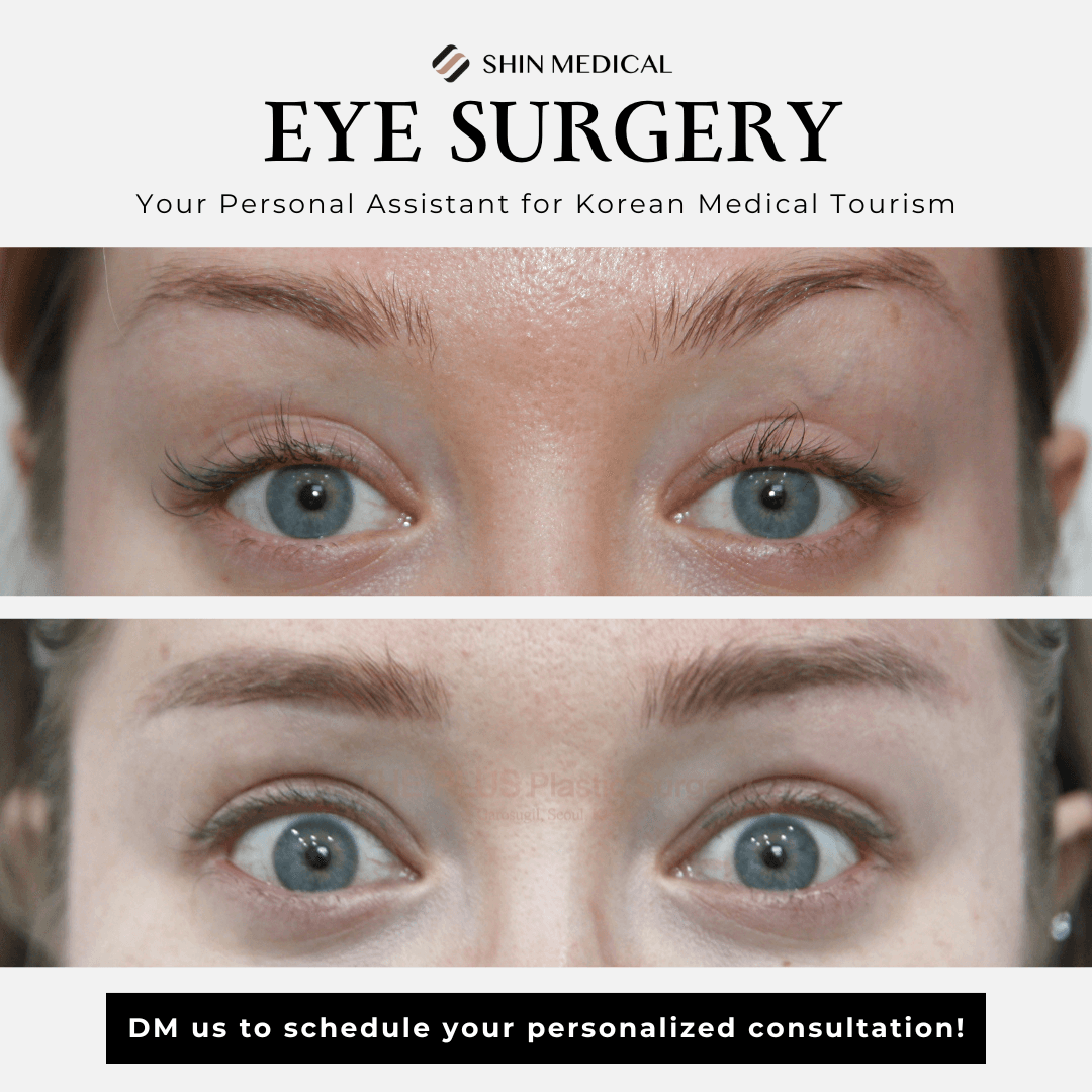 Ptosis Correction