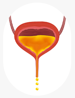 Female Incontinence