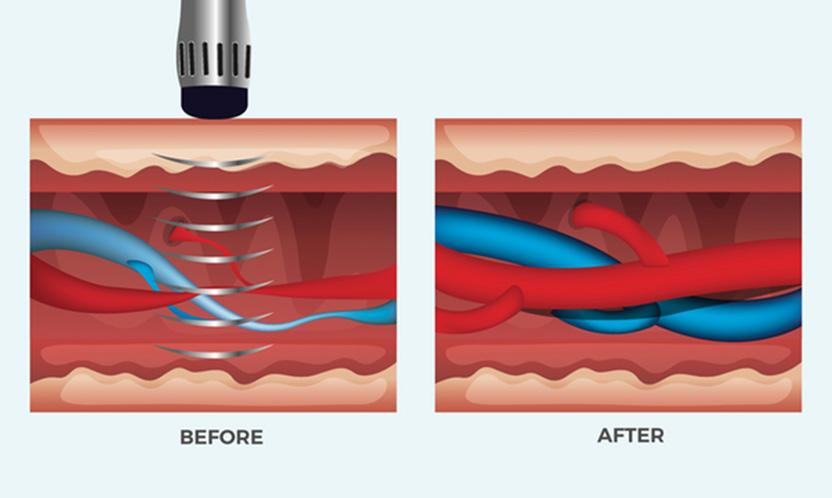 cost erectile dysfunction korea