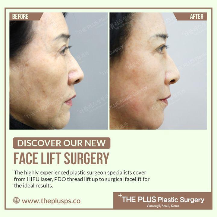 aging face korea