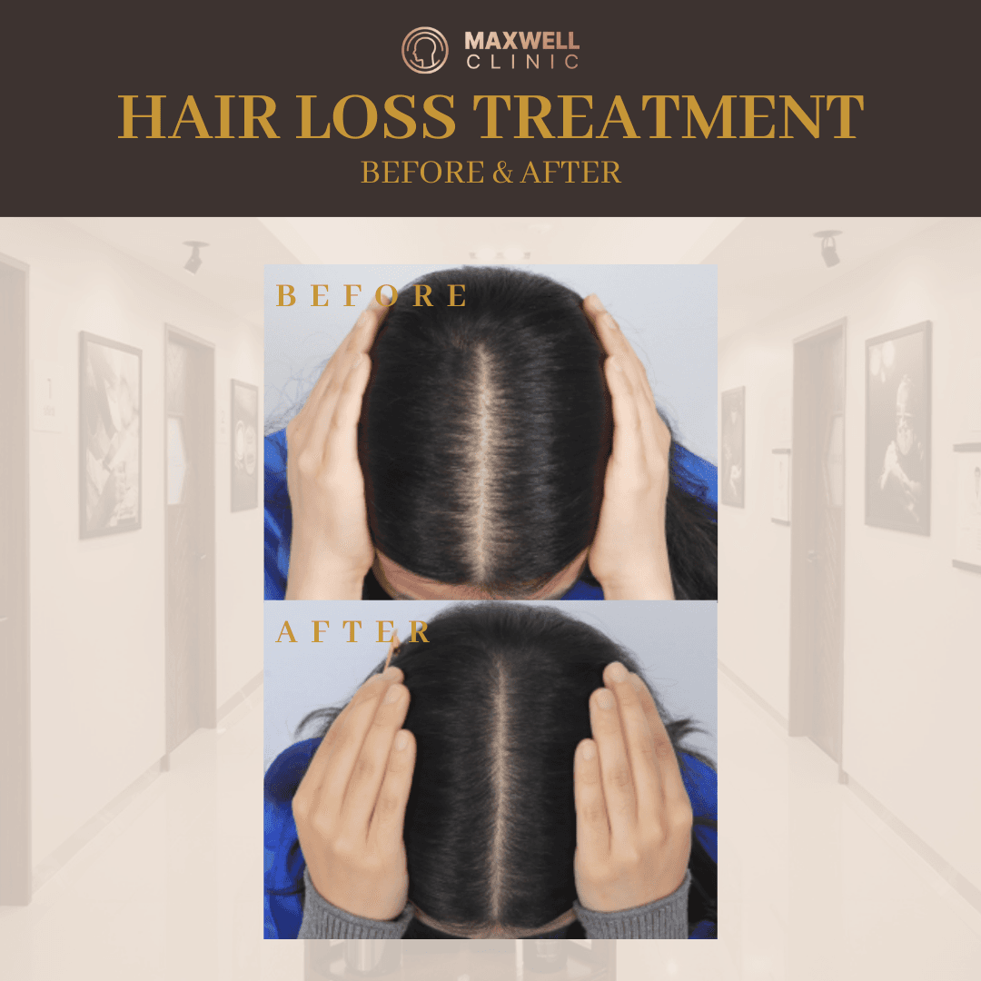 seasonal hair shedding korea
