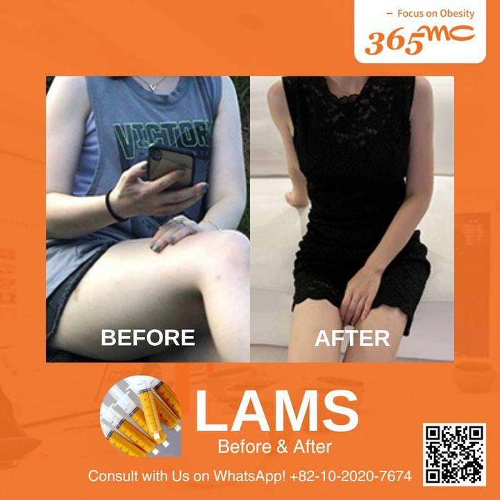 lams korea