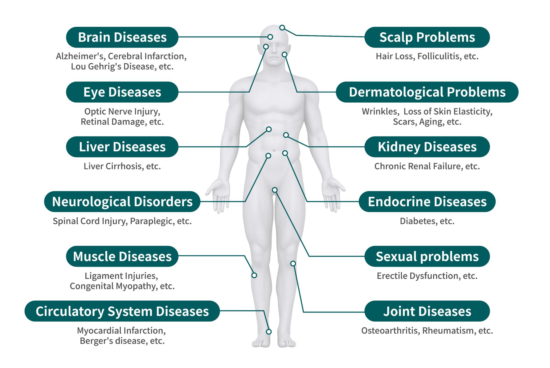 cost stem cell disease therapy korea