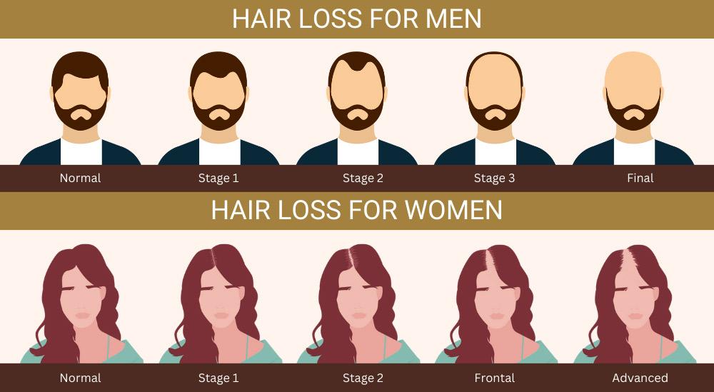 Hairline Correction, Hair Loss Treatment, Hair Transplant