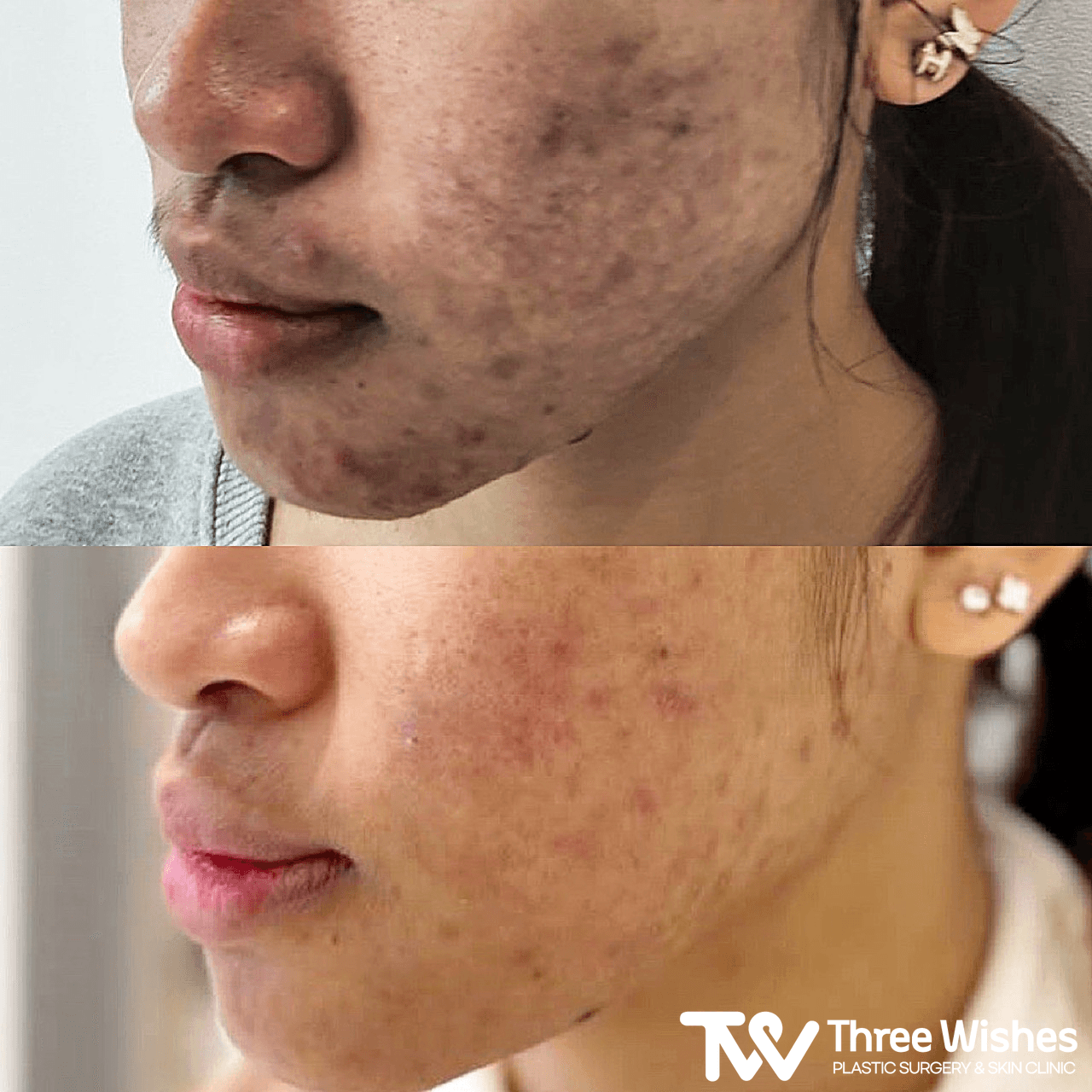 Three Wishes Clinic - Myeongdong before and after image