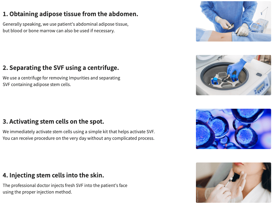 Stem Cell Facial, Stem Cell Acne Scar