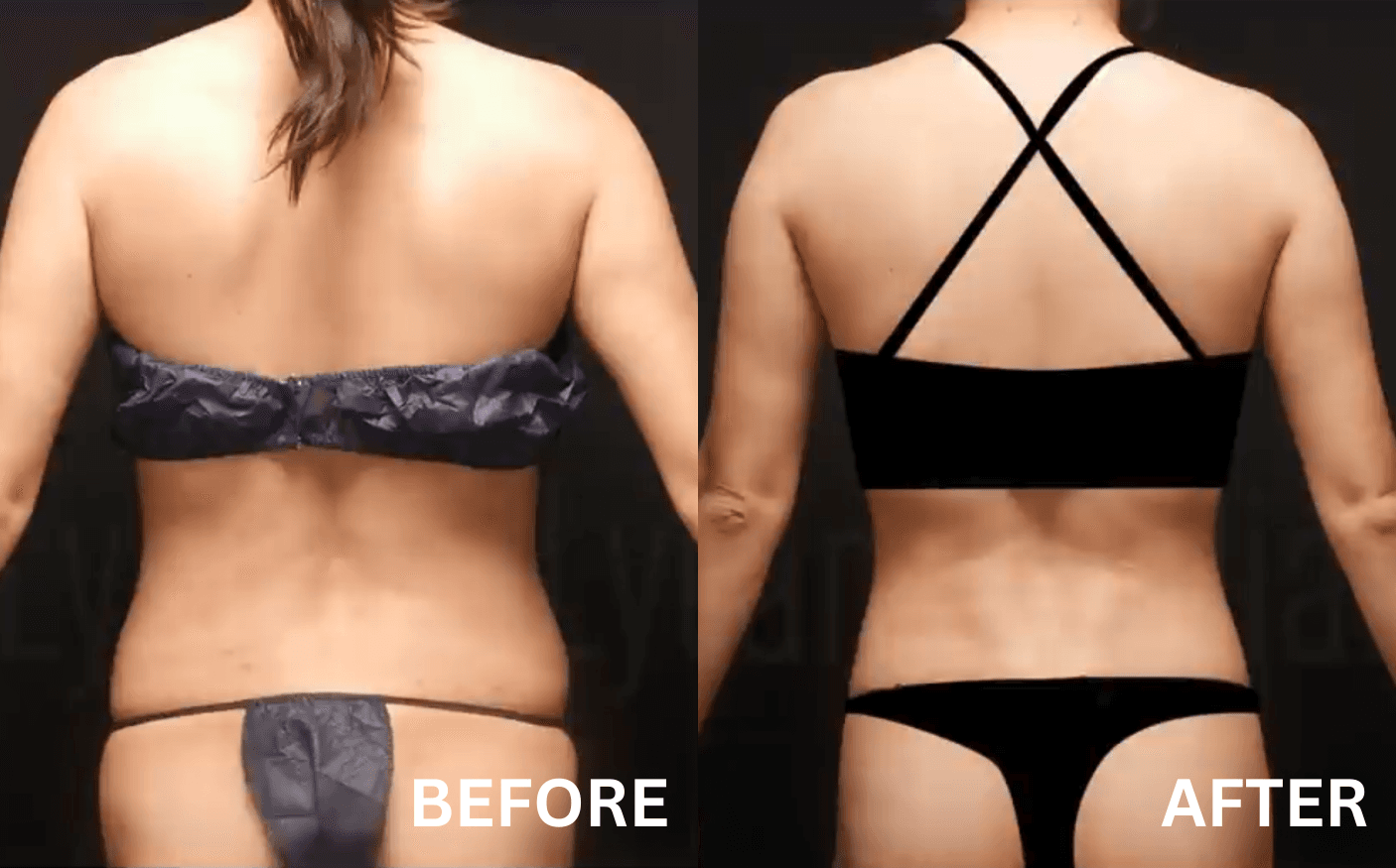 Lydian Plastic Surgery Clinic before and after image