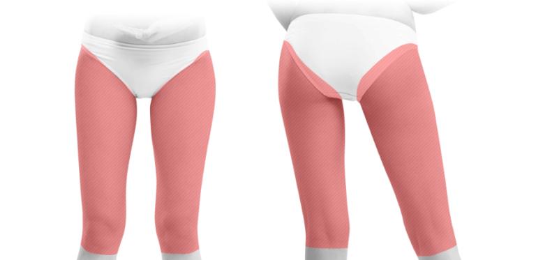Thigh Liposuction