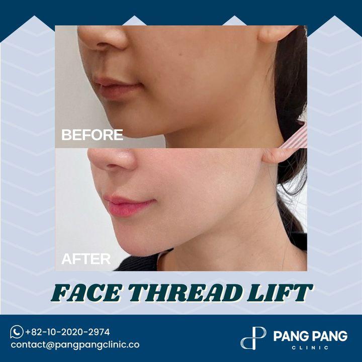 post pregnancy lax skin korea