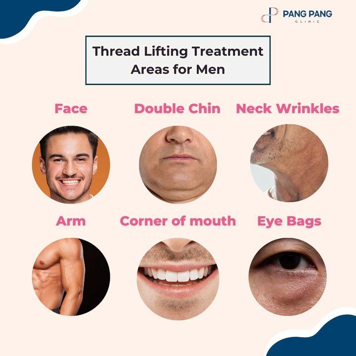 Thread Lift