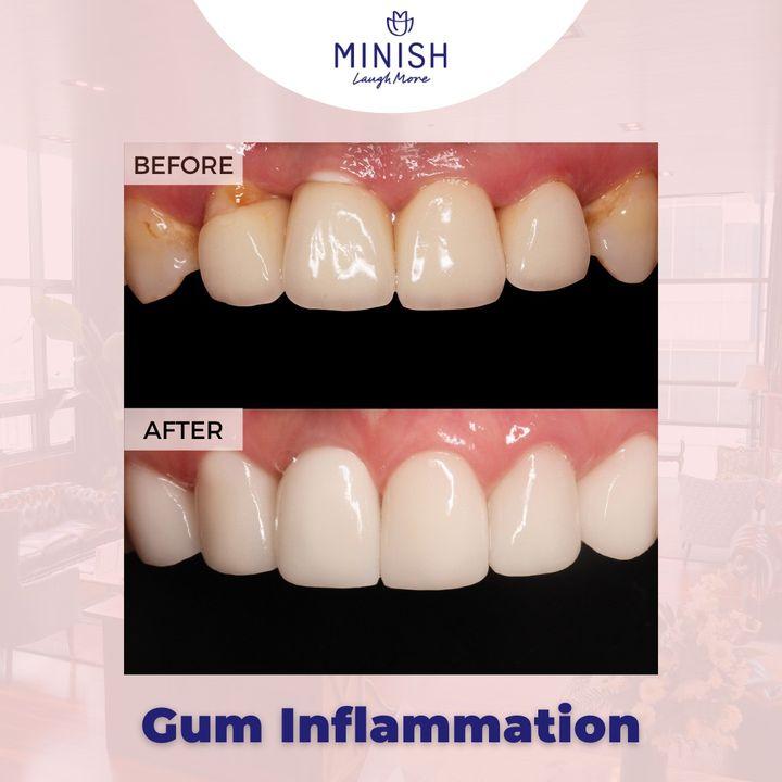 A smile is the best accessory, let us help you maintain it~