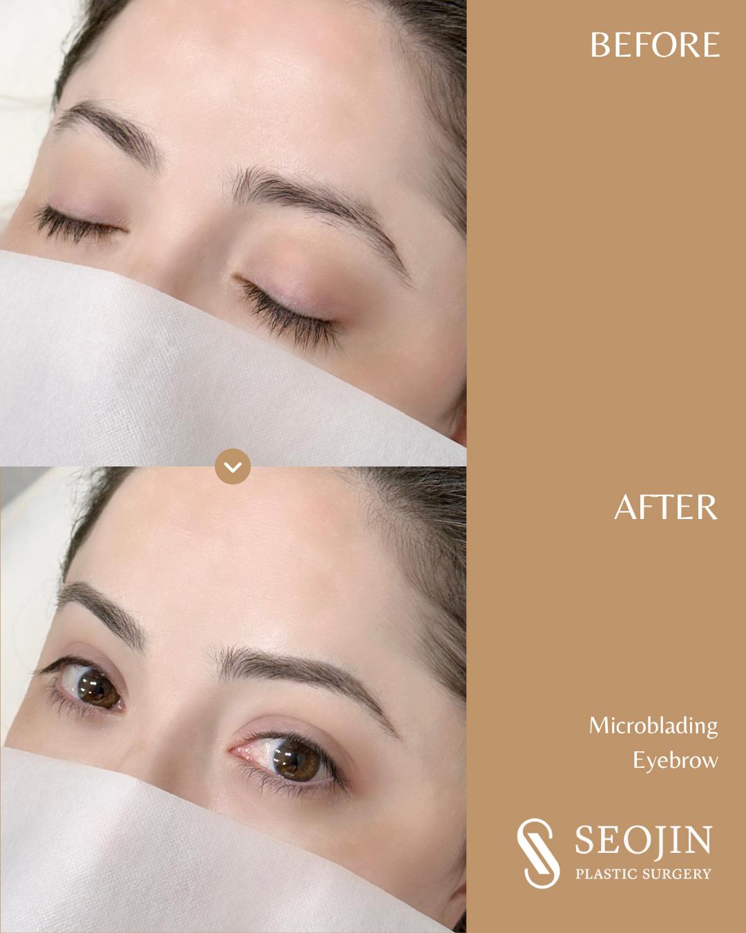 Microblading, Eyebrow Microblading