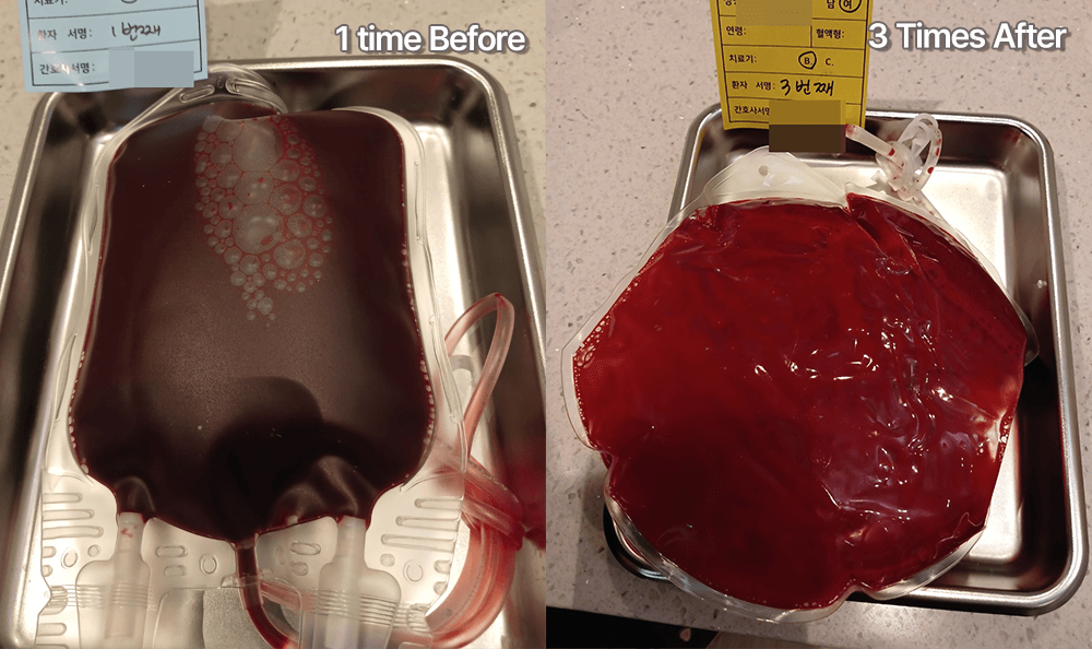 blood-purification-3-sessions-after.png
