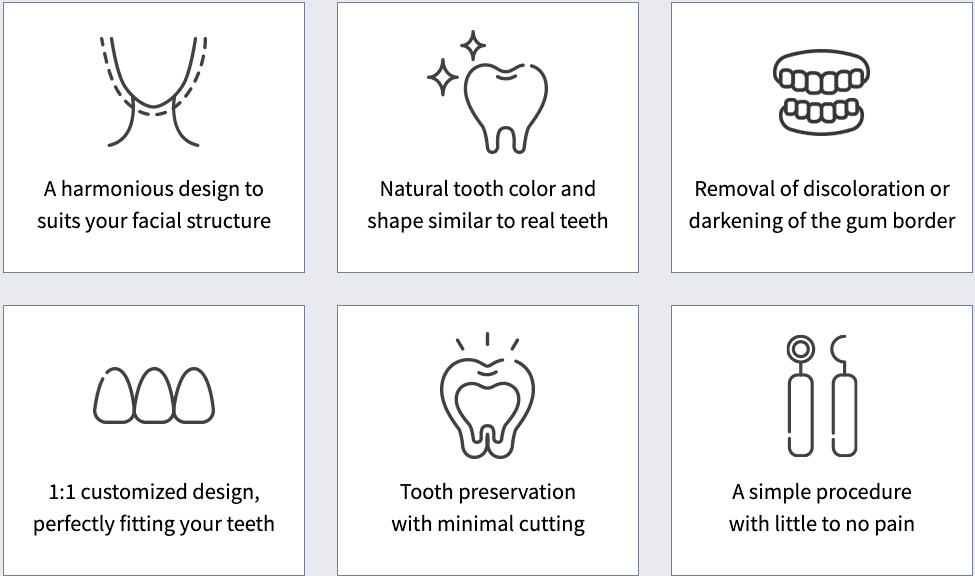 Veneers, All-ceramic Veneers