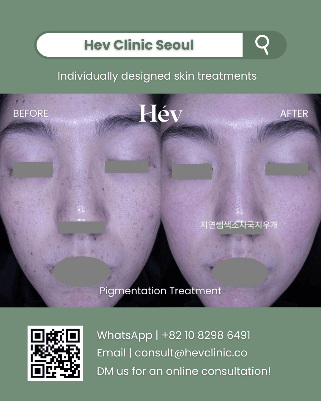 Pigmentation Treatment