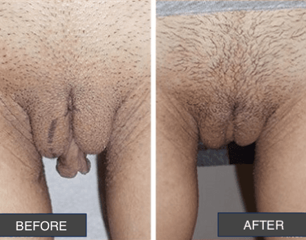 Okay Plastic Surgery Clinic before and after image