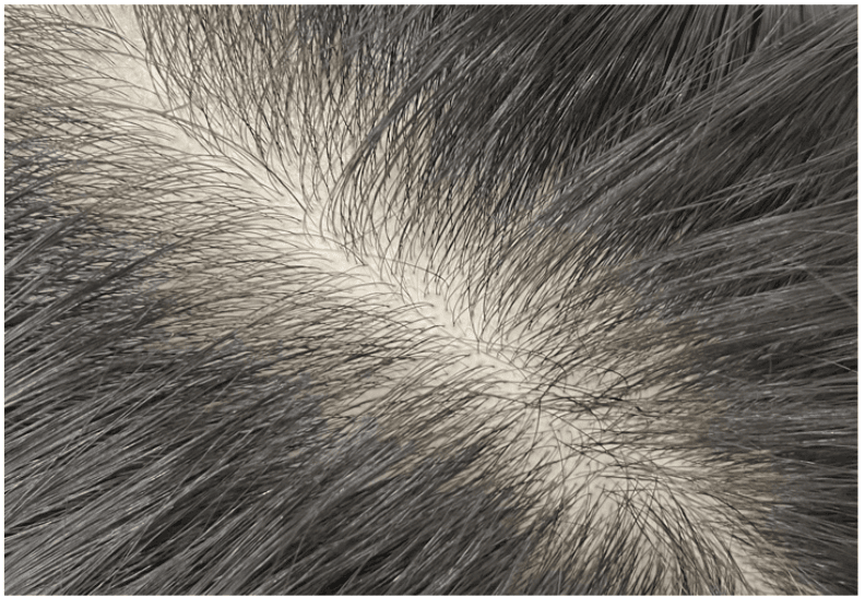Hairline Microblading