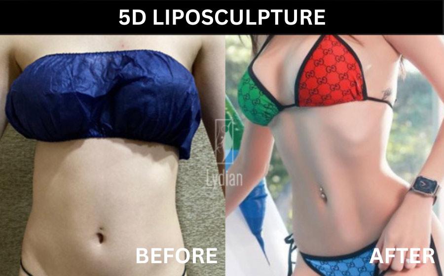Lydian Plastic Surgery Clinic before and after image