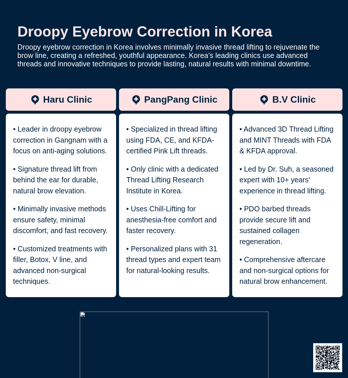 Forehead Thread Lift