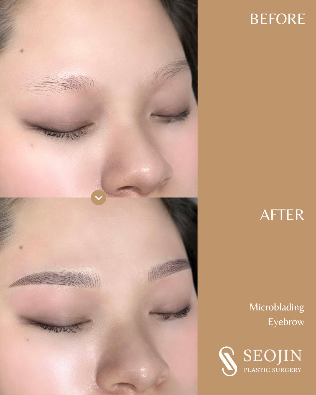 Microblading, Eyebrow Microblading