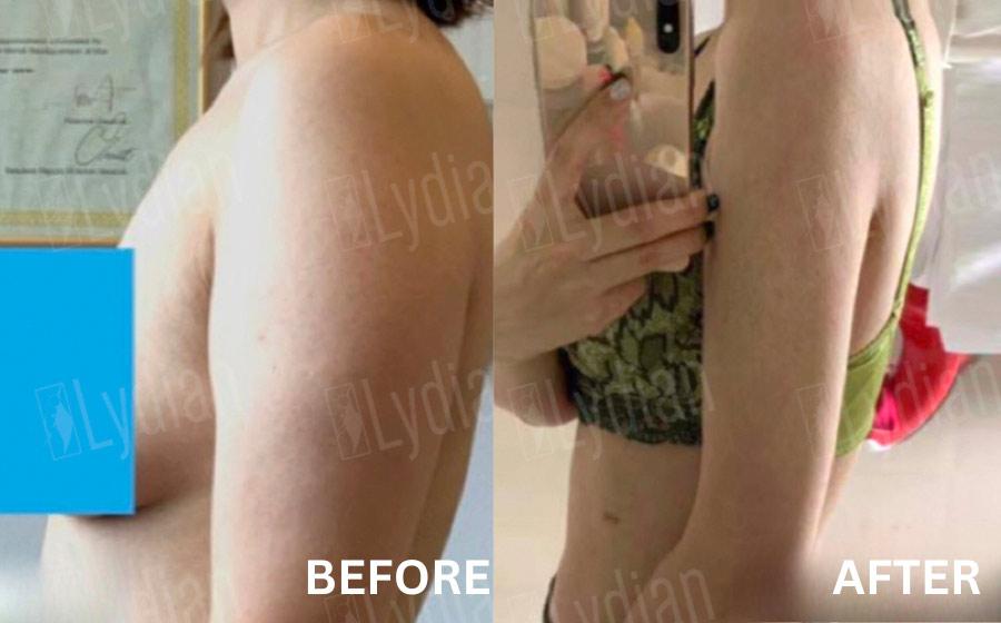 Lydian Plastic Surgery Clinic before and after image