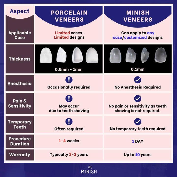 Veneers, All-ceramic Veneers