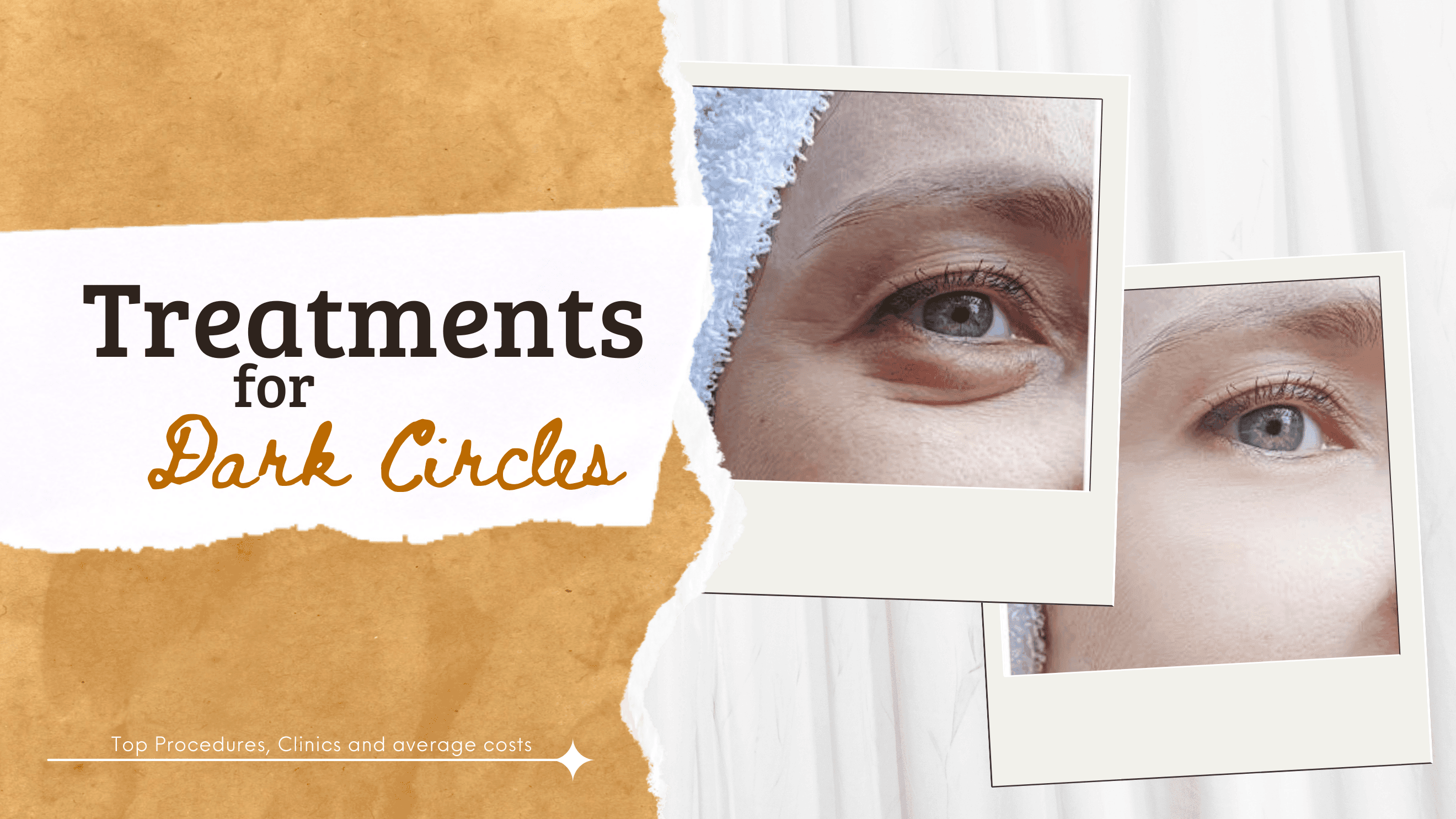Best Korean Treatments for Dark Circles: Top Procedures, Clinics, & Costs