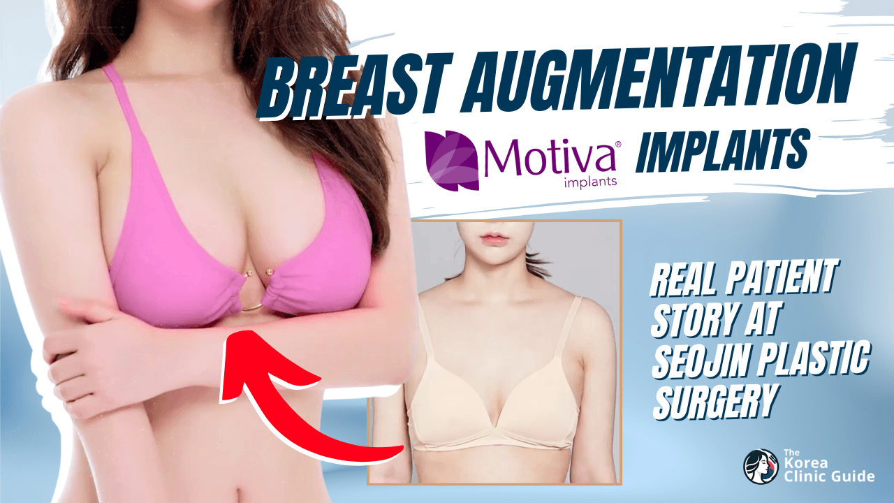 Brustvergrößerung mit Motiva-Brustimplantaten bei Seojin Plastic Surgery