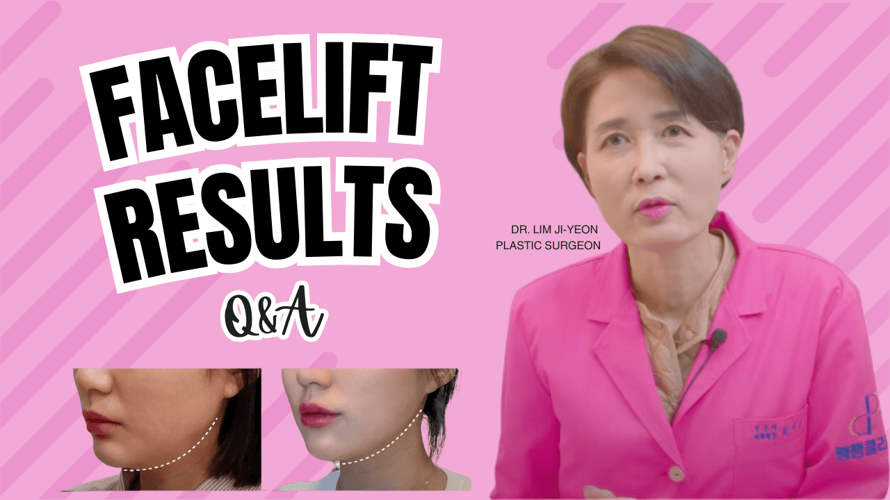 Double Chin Thread Facelifting in Korea Q&A with Pangpang Thread Lift Doctor